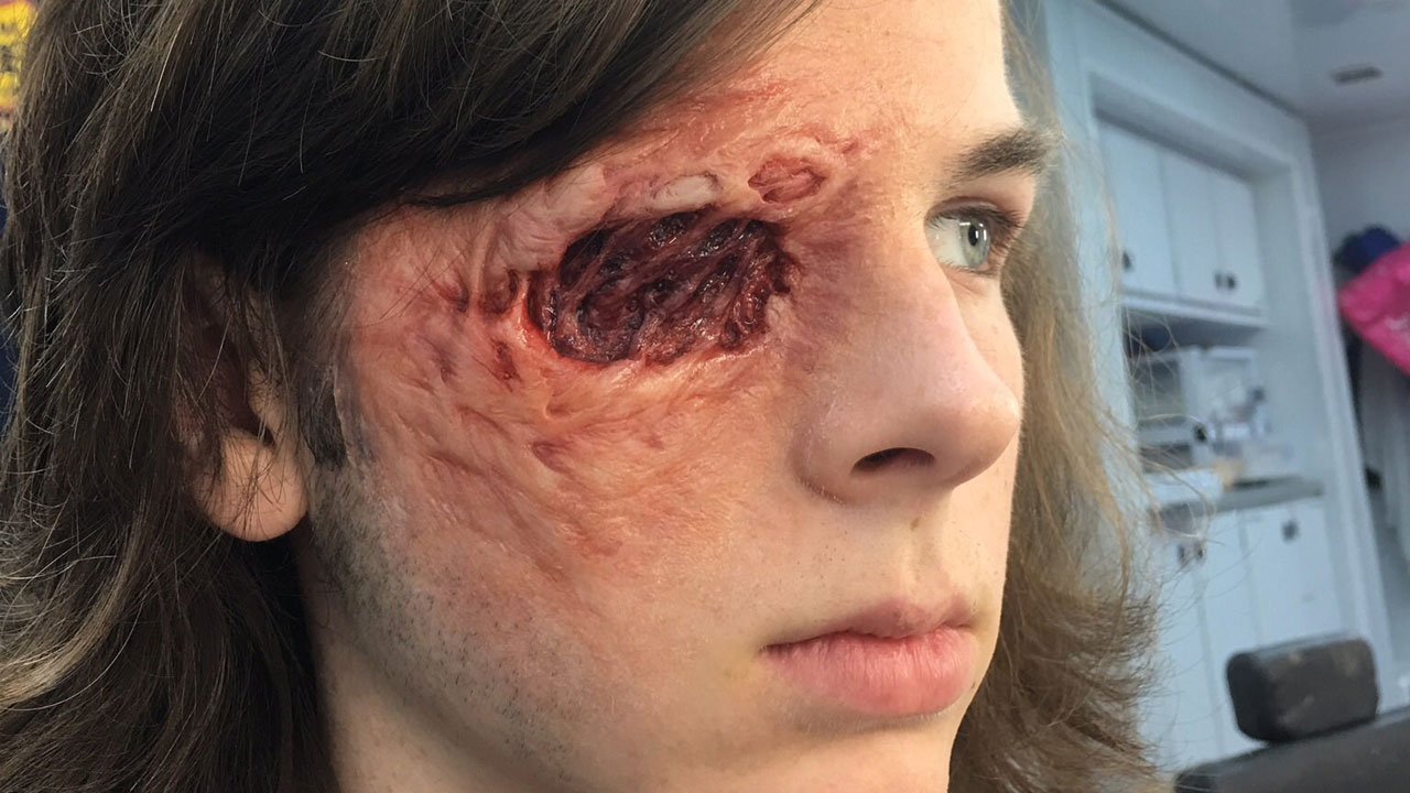 The Walking Dead 7ª Temporada | Veja fotos da maquiagem no olho do Carl sem os curativos