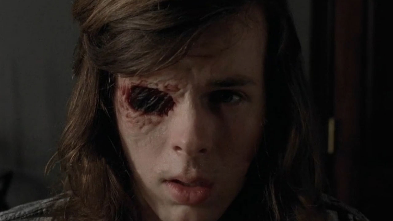 The Walking Dead 7ª Temporada | Reveja a cena em que Carl tira os curativos do olho